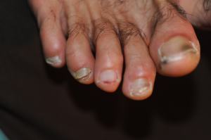 gross toes_0116