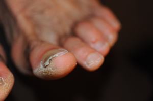 gross toes_0117