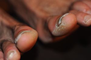 gross toes_0118