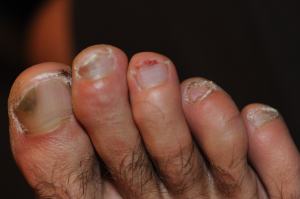 gross toes_0120